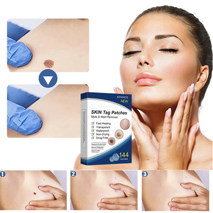 Parches Para Verrugas 144 Unidades