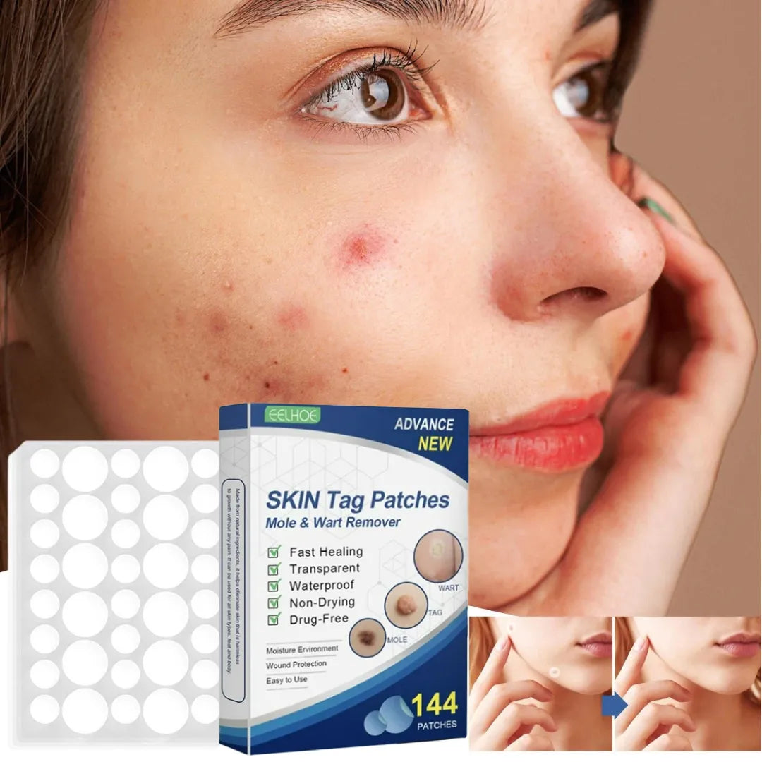 Parches Para Verrugas 144 Unidades