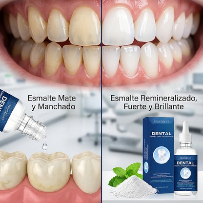 Kit Reparador Dental – Alivio Rápido y Protección de Dientes