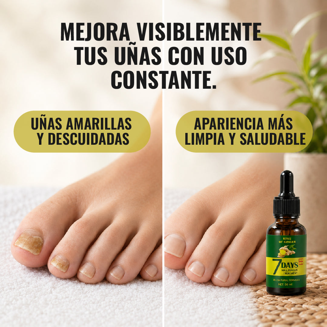 Tónico Jengibre uñas Antifúngico 7 Days