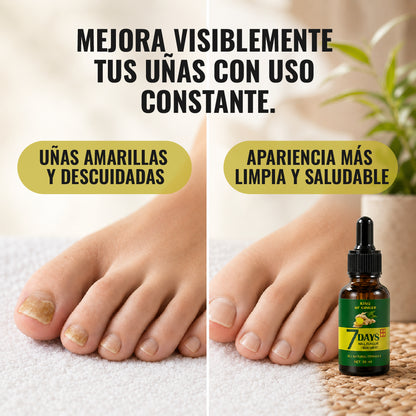 Tónico Jengibre uñas Antifúngico 7 Days