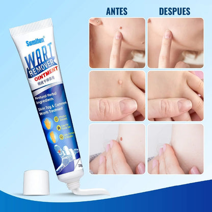 Pomada Crema Sumifun Elimina Verrugas
