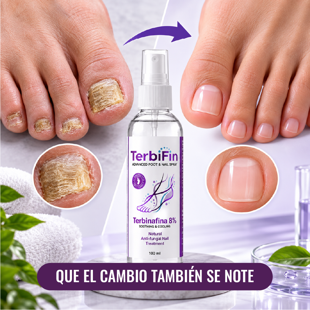 Terbifin™ - Spray Antihongos para Pies y Uñas
